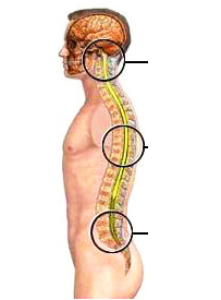 the stages of development of degenerative disc disease