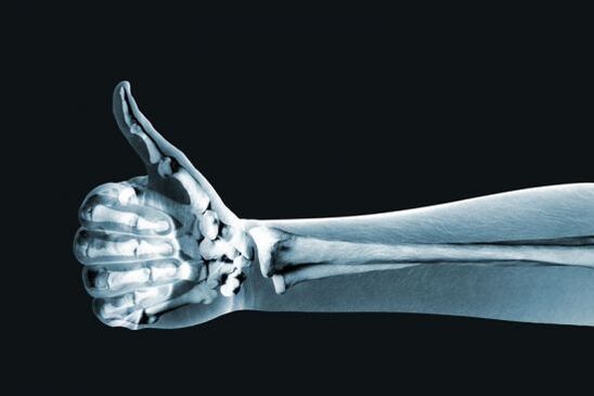 X-rays can help diagnose pain in the finger joints