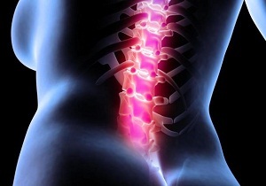 causes of pain in the back