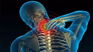 causes of neck osteochondrosis